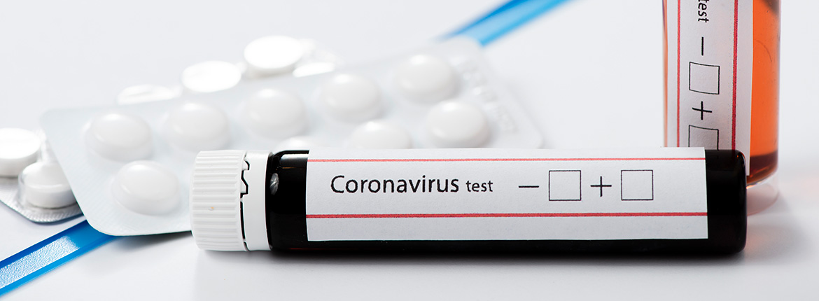 Anvisa autoriza testes rápidos para Covid-19 em farmácias
