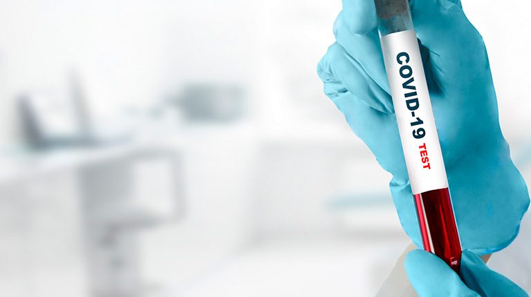 Vacina contra Coronavírus: Governo de SP confirma início de testes em humanos